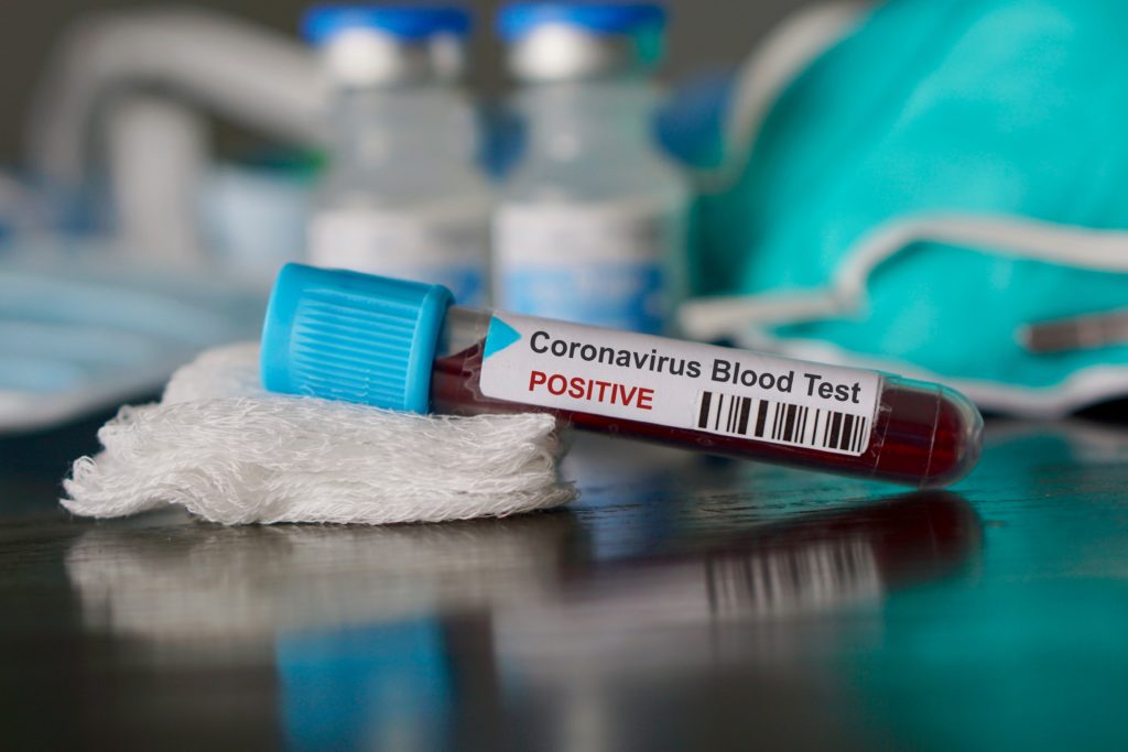 positive coronavirus test